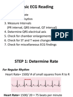 Basic ECG Reading