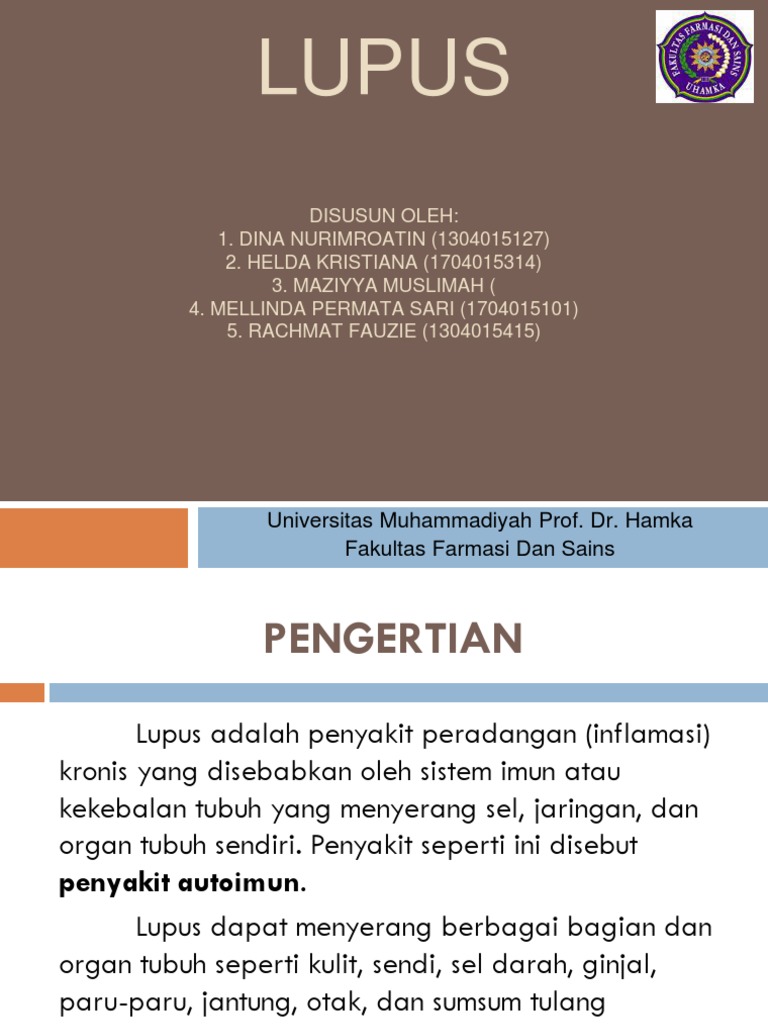 Lupus