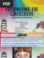 Síndrome de Crouzon 