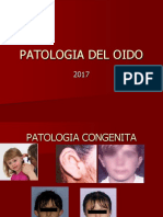 Patologia Del Oido Externo, Medio Interno