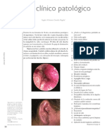 Otitis Externa Difusa Casos