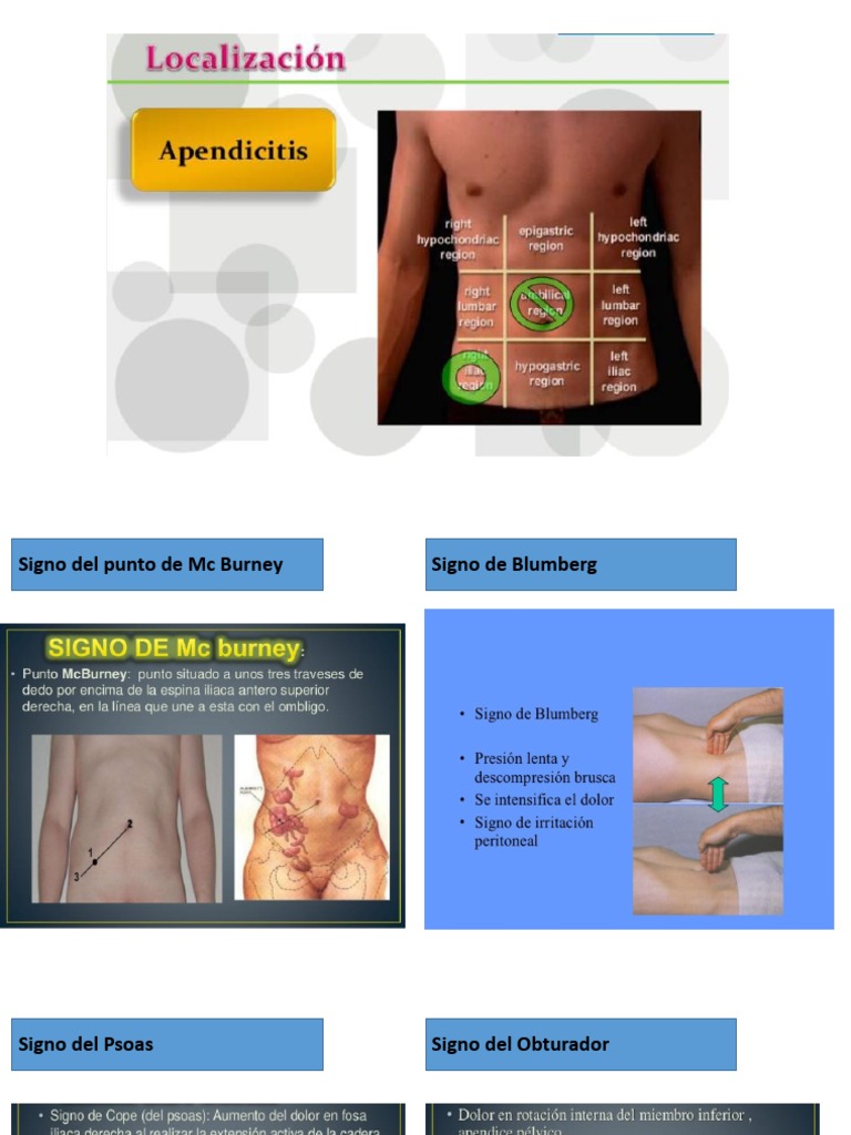 Apendicitis Signos | PDF