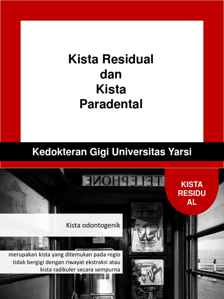 Kista Residual