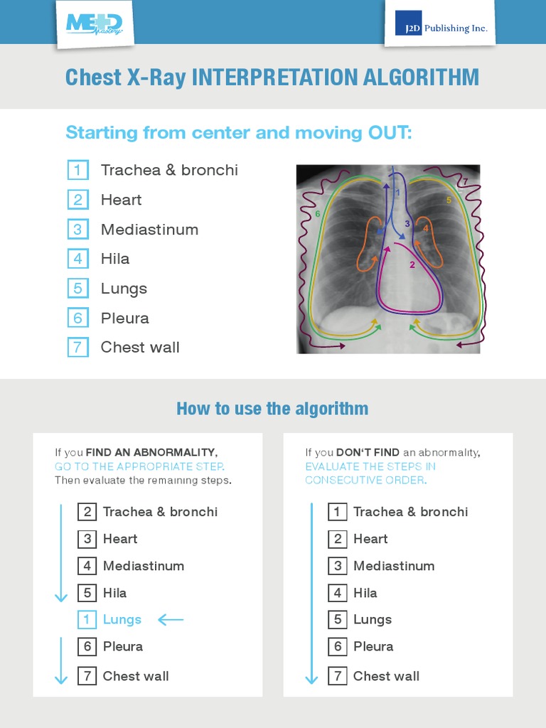 Chest X Ray Diagnostic Algorithm | PDF | Thorax | Lung