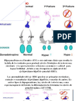 Hipogonadismo Masculino