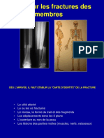 1-Fractures generalites.ppt