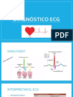 Diagnóstico ECG - Oliver González