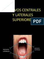 Incisivos Centrales y Laterales Superiores