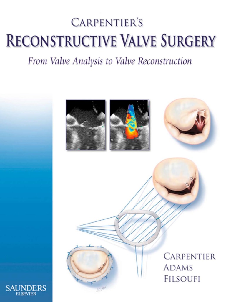 カーペンティアReconstructive valve surgery Carpentier's Reconstructive Valve Surgery: 9780721691688