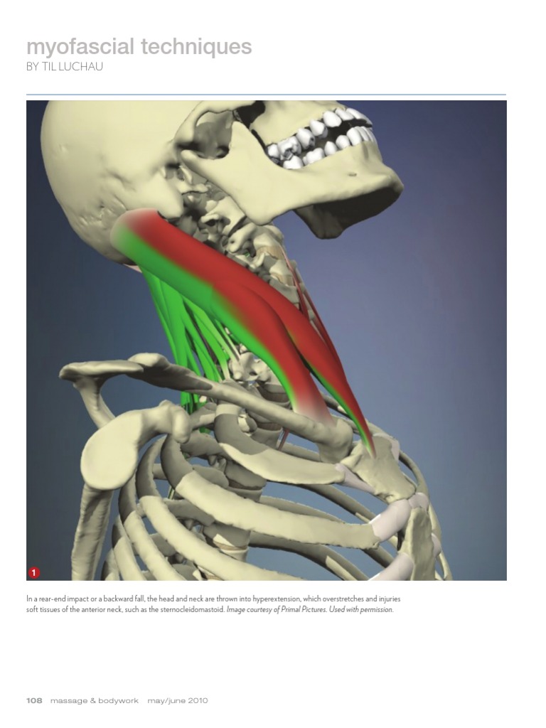 Working With Whiplash, Part II (Myofascial Techniques) PDF Vertebra