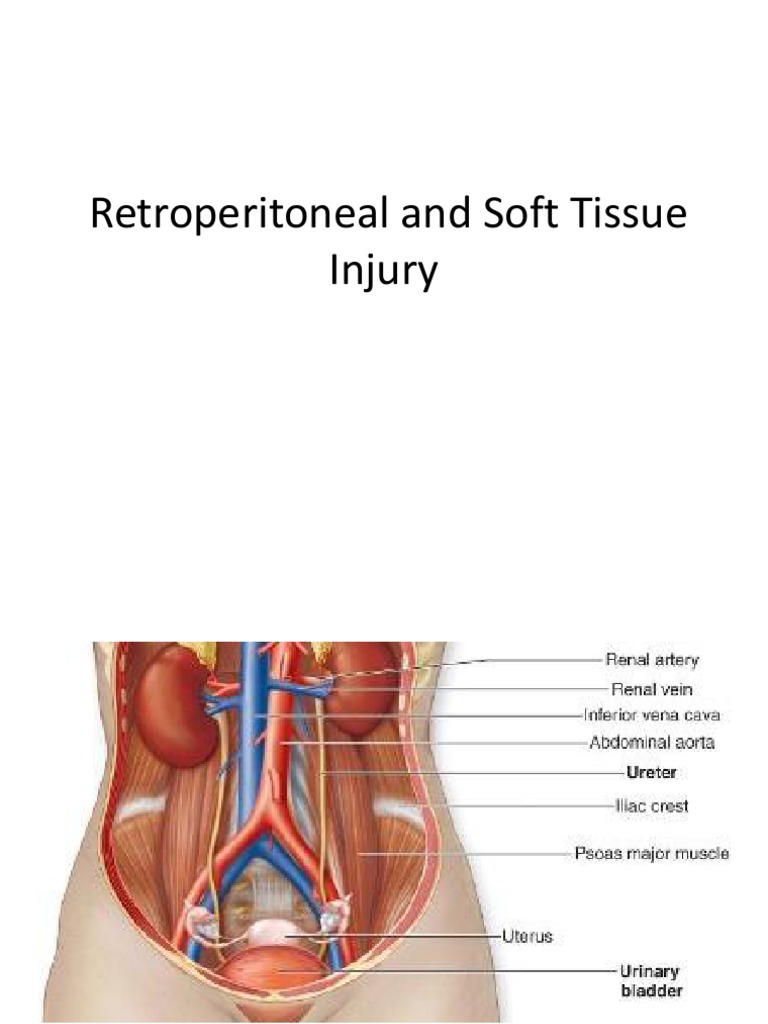 Retroperitoneal Injury and Trauma Zones | PDF | Major Trauma | Kidney