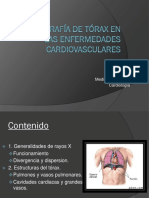 Radiografía de Tórax en Las Enfermedades Cardiovasculares
