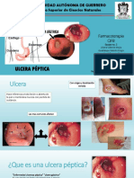 Farmacoterapia ULCERA PEPTICA