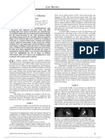 Childhood Optic Nerve Glioma: Vision Loss Due To Biopsy