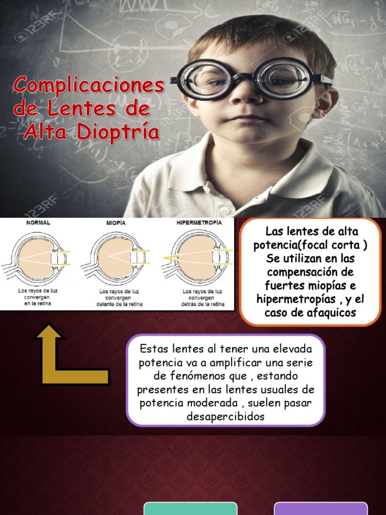 complicaciones-altas-dioptrias-pdf-lentes-ojo-humano