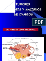 Tumores Benignos y Malignos de Ovario