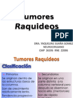 Tumores Raquideos