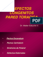 Defectos Congénitos de La Pared Torácica