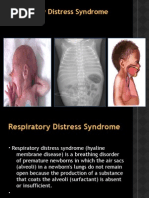 Respiratory Distress Syndrome (Newborn)