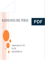 Radiologia Del Torax D II