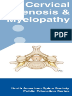 Cervical Stenosis + Myelopathy