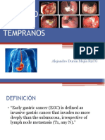 Cancer Gastrico.b