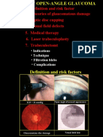 28Primary Open Angle Glaucoma