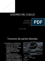 Cuello Masas y Linfonodos PDF
