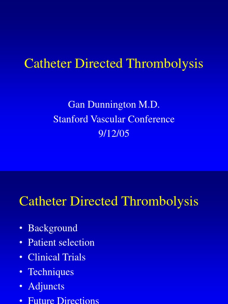 Catheter Directed Thrombolysis Gan Dunnington M.D. Stanford Vascular