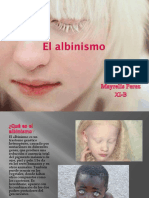 El Albinismo