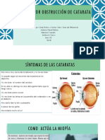 Visión Por Obstrucción de Catarata