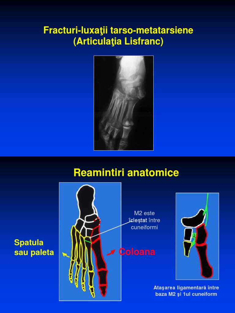 poliartrita reumatoida maini ligamentul durerii la încheietura mâinii