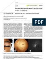 Traumatic Optic Neuropathy and Central Retinal Artery Occlusion Following Blunt Trauma To The Eyebrow