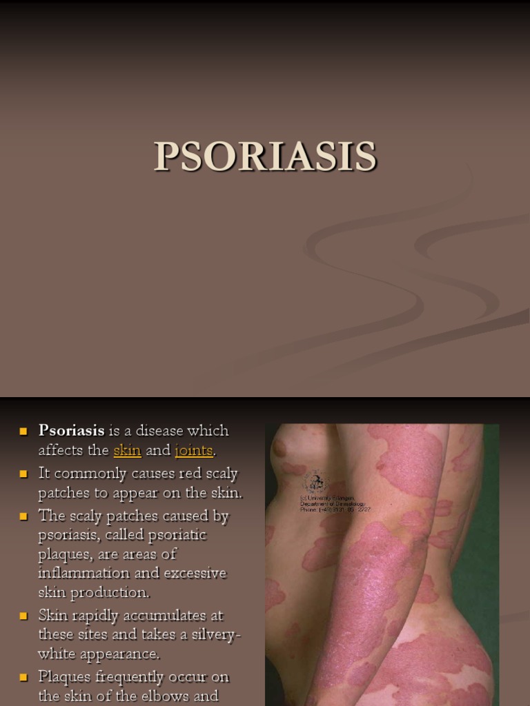 PSORIASIS.ppt Psoriasis Diseases And Disorders Free 30day Trial
