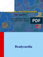 Bradycardia and Tachycardia