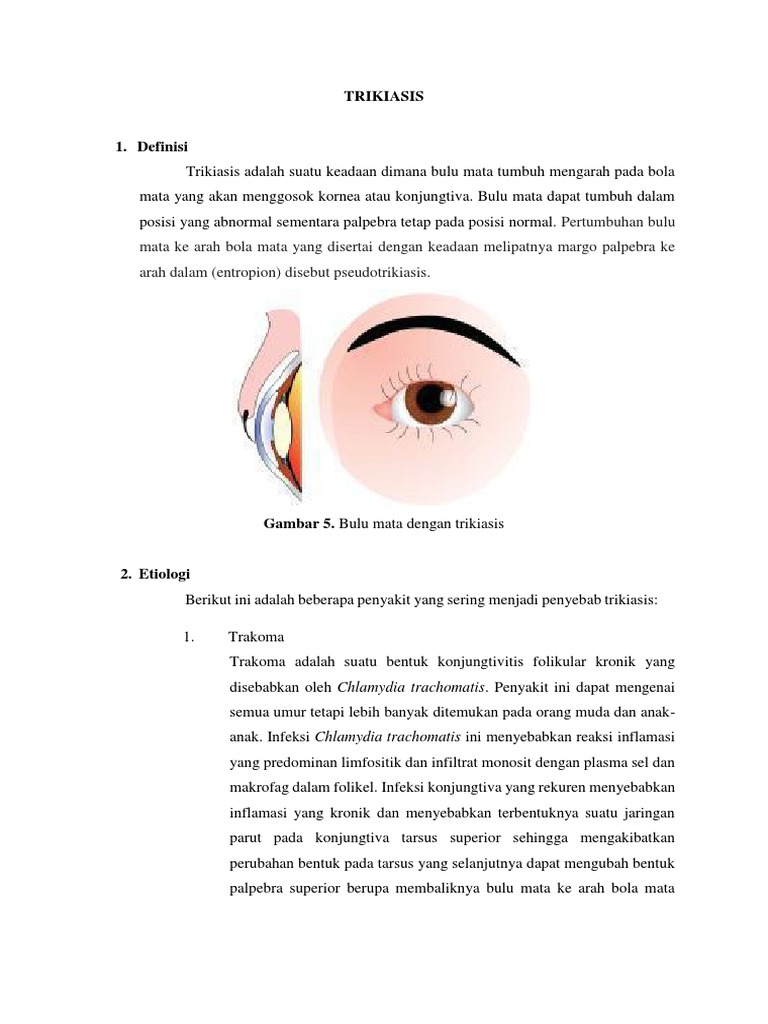Tatalaksana dan Penyebab Trikiasis | PDF