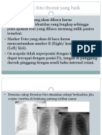 Radiologi Pneumonia