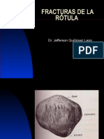 Fracturas de Rotula Jefersson