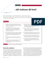 Síndrome-del-túnel-carpiano-2013.pdf