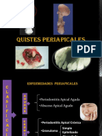quisteperiapical-121206145511-phpapp01