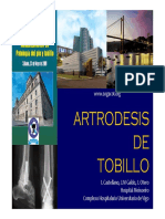 Artrodesis de tobillo.pdf
