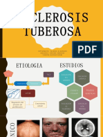 Esclerosis Tubberosa