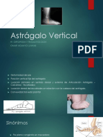 Astrágalo Vertical