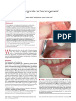 Oral Ulcer Diseases DD