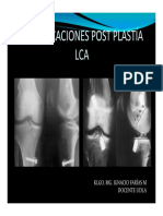 Complicaciones Post Plastia Lca