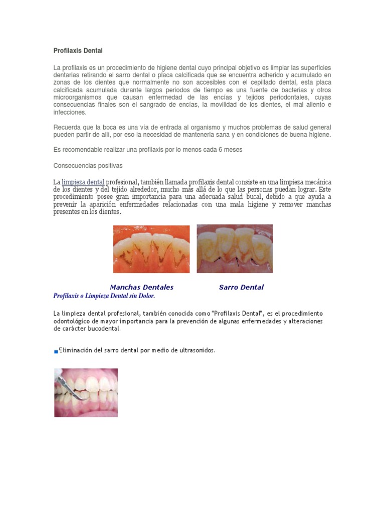 Profilaxis Dental | PDF | Diente | Ramas de Odontología