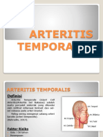 Arteritis Temporalis
