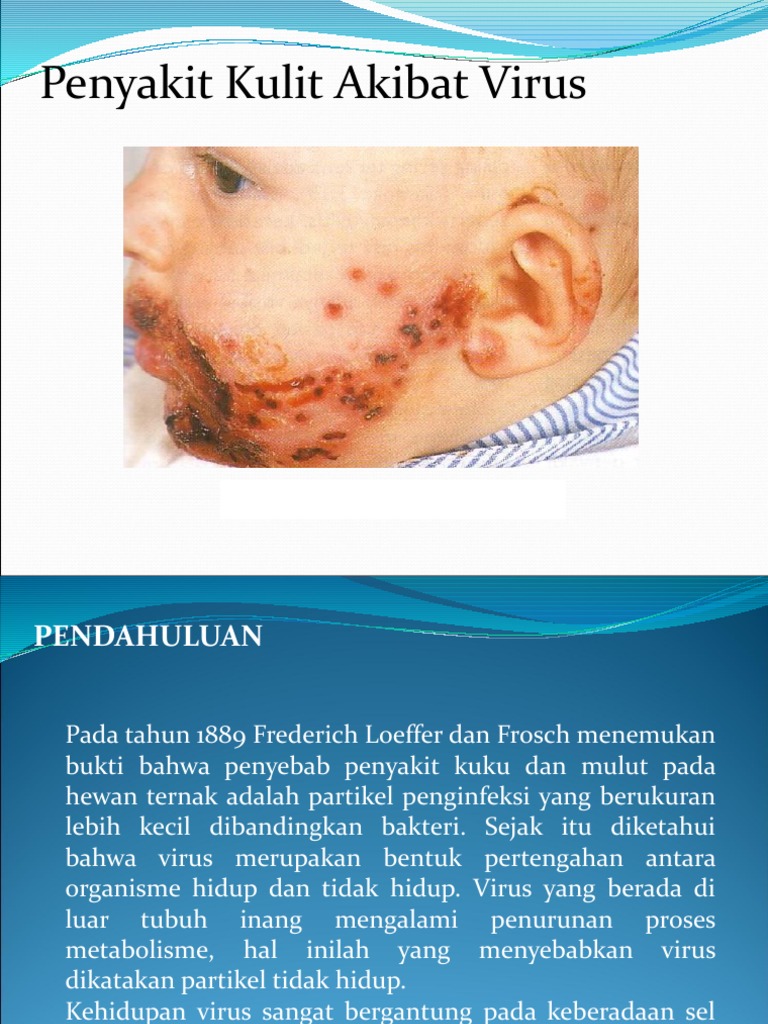 Ft Integument Penyakit Kulit Akibat Virus