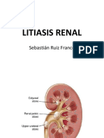 Caso Clínico Litiasis Renal