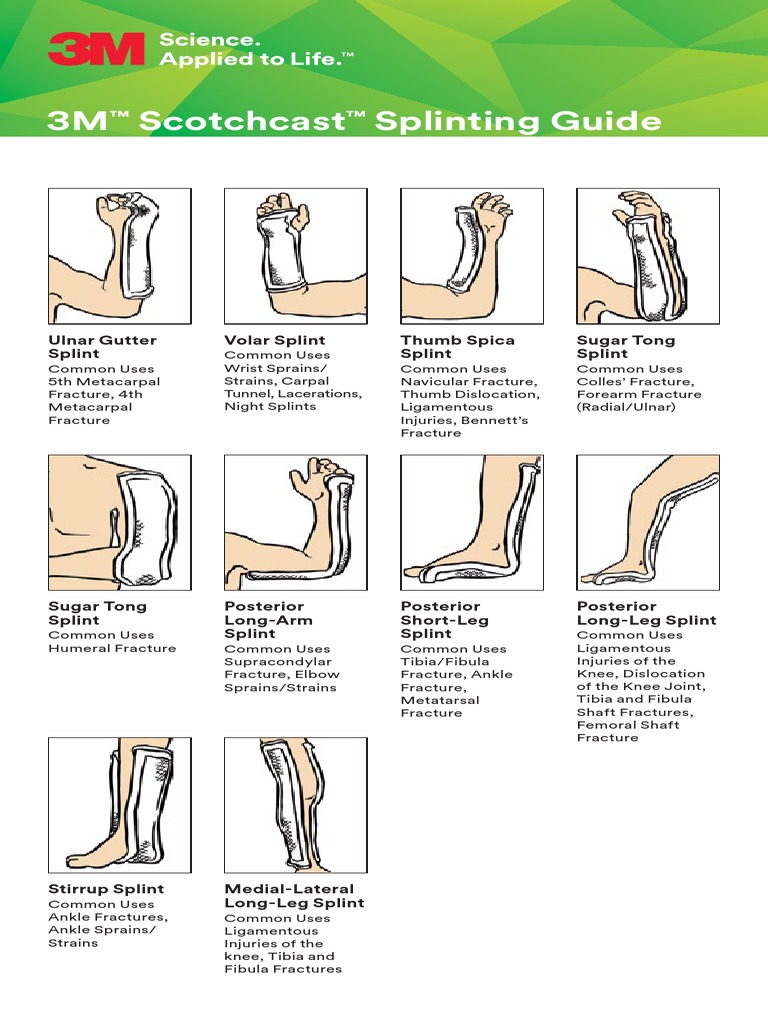 Sugar Tong Splint Ankle
